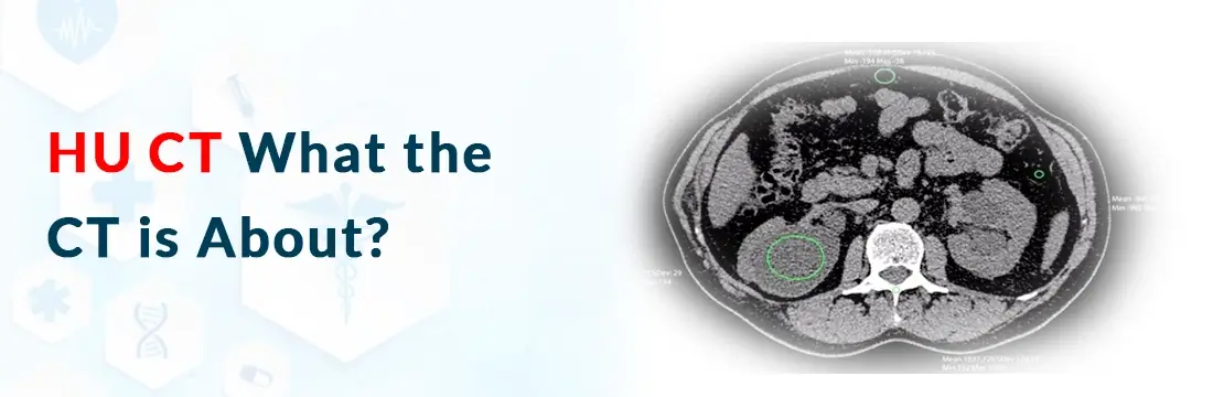HU CT: What the CT is About?